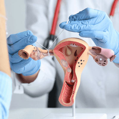 Myomectomy in Dubai