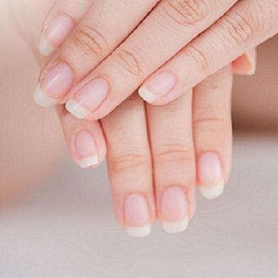 Nail Abnormalities Symptoms, Causes, and Prevention 1 Nail Abnormalities Symptoms, Causes, and Prevention