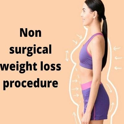 Non-Surgical Procedures for Weight Loss 1 Non-Surgical Procedures for Weight Loss