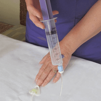 Optimal Home Enteral Nutrition in Dubai 1 Optimal Home Enteral Nutrition