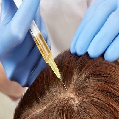 PRP Cost in Abu Dhabi 1 PRP Cost in Abu Dhabi