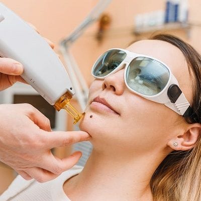 Pigmentation Laser Treatment Cost in Dubai