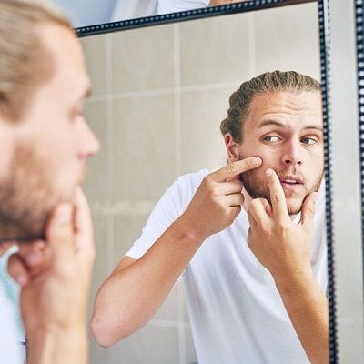 Pimple Treatment For Men In Dubai