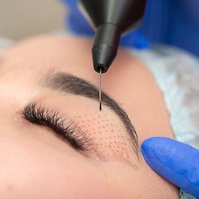 Plexr Plasma Eyelift in Dubai