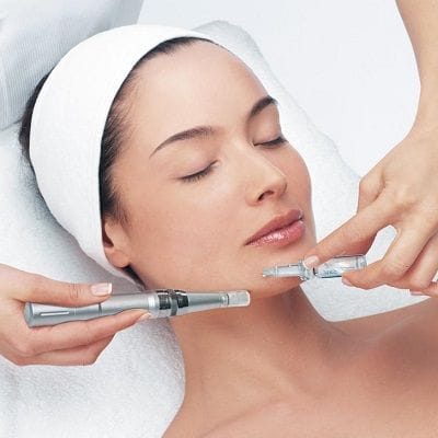 Prp Micro-needling For Hyperpigmentation in Dubai