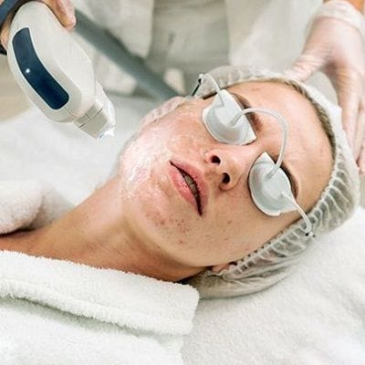 Reduce Pimple Scars on Face Dubai & Abu Dhabi Dynamic Clinic