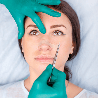Rhinoplasty Recovery after Your Nose Job 1 Rhinoplasty Recovery After Your Nose Job