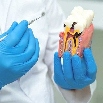 Root Canal Infection Cost in Dubai 1 Root Canal Infection Cost in Dubai