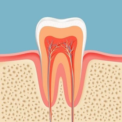 Root Canal Treatment Cost in Dubai