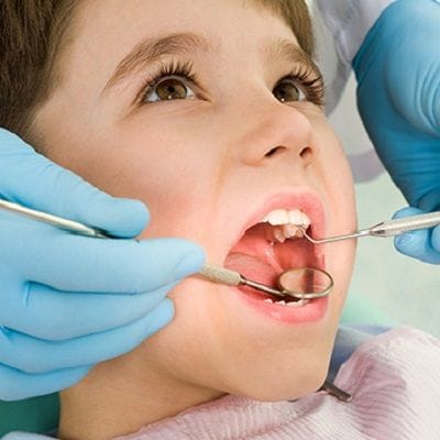 Root Canal Treatment for Infected Tooth 1 Root Canal Treatment for Infected - Tooth Root Canal Infection Treatment - Dynamic Clinic