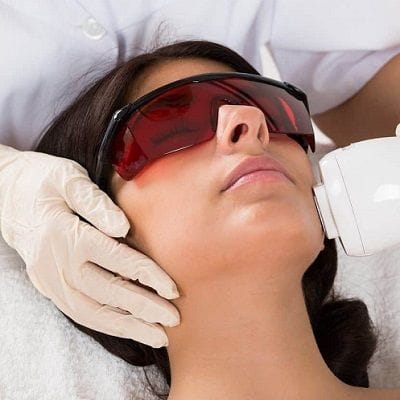 Rosacea Cheeks Treatment