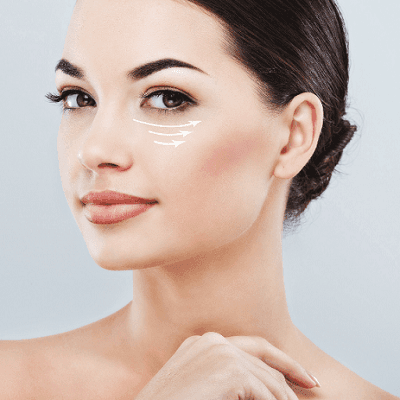 Say Goodbye to Tired Eyes: The Dubai Guide to Eye Bag Removal 1 Say Goodbye to Tired Eyes The Dubai Guide to Eye Bag Removal