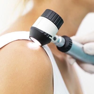 Skin Diseases Treated by a Dermatologist 1 Skin Diseases Treated by a Dermatologist