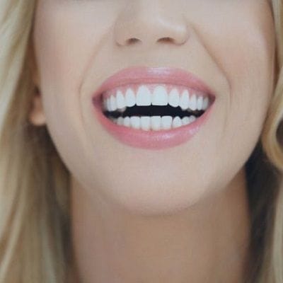 Smile Brighter & Whiter with Teeth Cleaning 1 Smile Brighter & Whiter with Teeth Cleaning