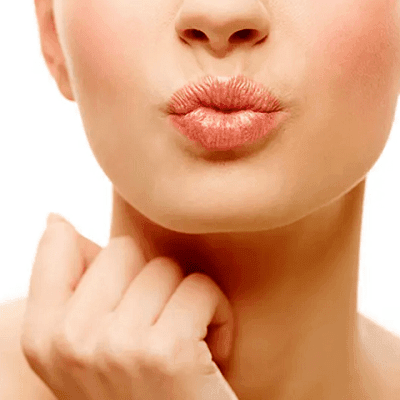 Subtle Lip Lift in Dubai 1 Subtle Lip Lift in Dubai