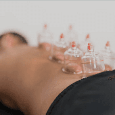 Sunnah Hijama in Dubai 1 Sunnah Hijama in Dubai, Abu Dhabi & Sharjah