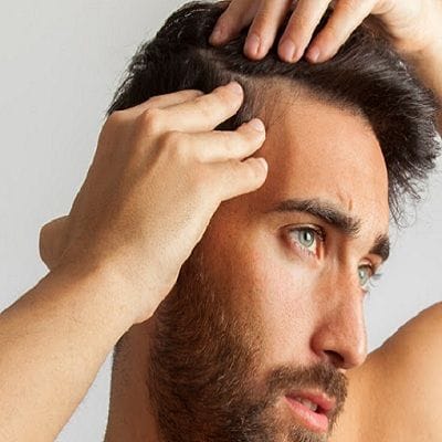 Synthetic Hair Transplant 1 Synthetic Hair Transplant