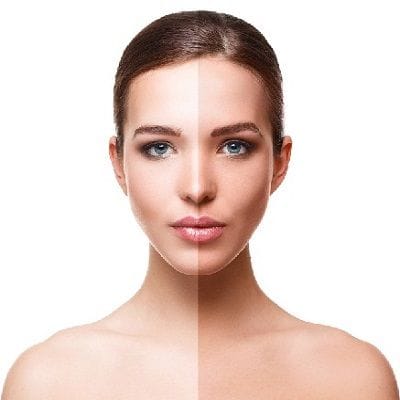 Tan Removal Treatment Cost 1 Tan Removal Treatment Cost