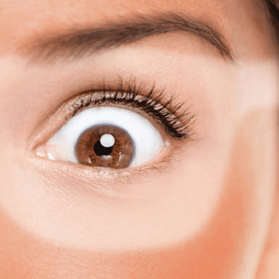 Tan Removal Treatment Options in Dubai