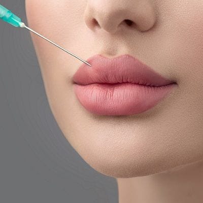 Russian Lip Filler Price 1 The Cost of Russian Lip Fillers