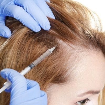The Journey to Fuller Hair: Best PRP Treatment 1 The Journey to Fuller Hair: Best PRP Treatment