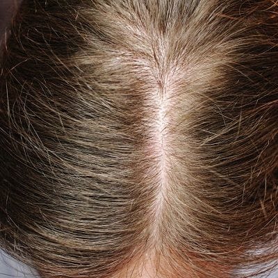 The Ordinary Multi Pepride Serum for Hair Density in Dubai & Abu Dhabi Dynamic