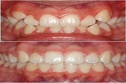 Top Orthodontists in Dubai