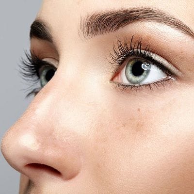 Ultrasonic Rhinoplasty