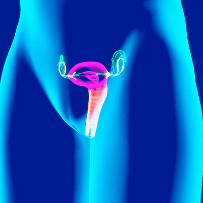 Vaginal Relaxation Syndrome in Dubai