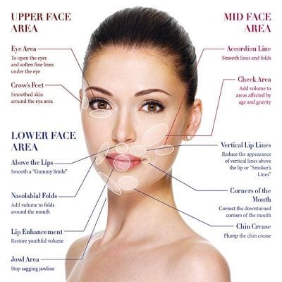 vampire facelift in Dubai