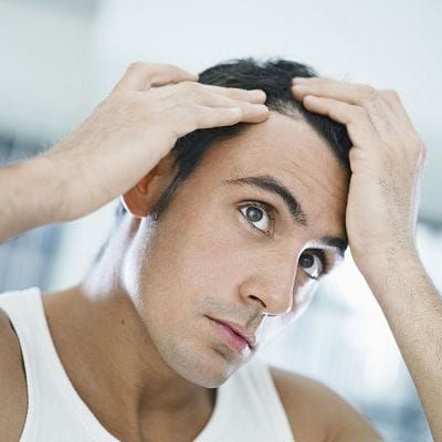 Various Strategies Available for Hair Implants 1 Various Strategies Available for Hair Implants in Dubai