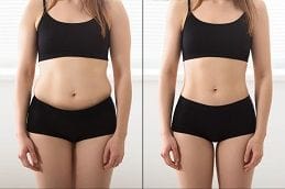 Weight Loss Injections Before and After
