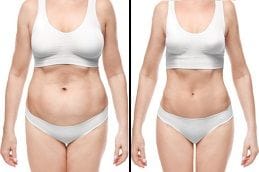 Weight Loss Injections Dubai Before and After