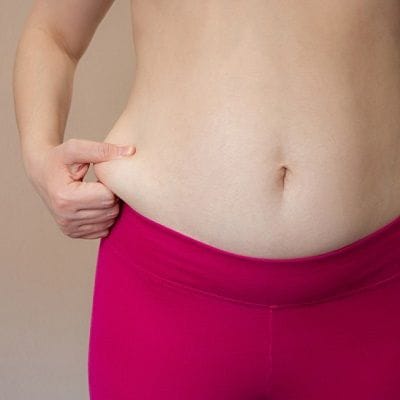 Weight Loss With Body Contouring Treatment in Dubai