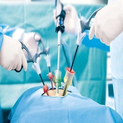 What Are The Benefits Of A Mini Gastric Bypass In Dubai