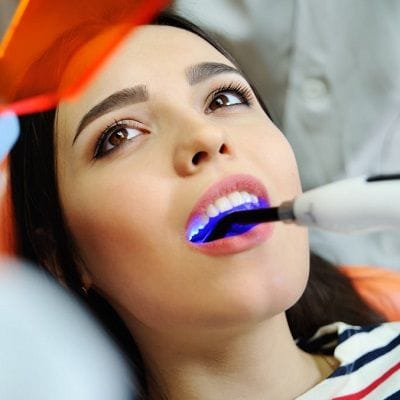 What Are The Types Of Dental Fillings In Dubai 1 What Are The Types Of Dental Fillings In Dubai Dental Fillings Cost