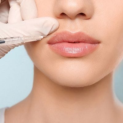 What Not To Do After Lip Injections 1 What Not To Do After Lip Injections