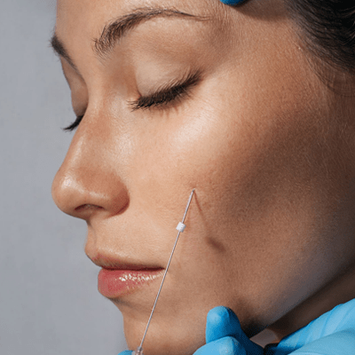 What is the Best Age for a Thread Lift?