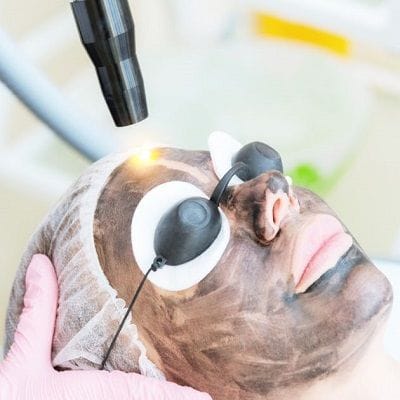 What is the Cost of Spectra Laser Carbon Peel in Dubai? 1 What is the Cost of Spectra Laser Carbon Peel in Dubai?