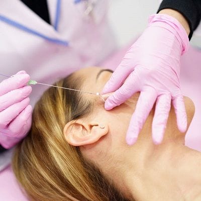 What to Expect During a PDO Threading Session
