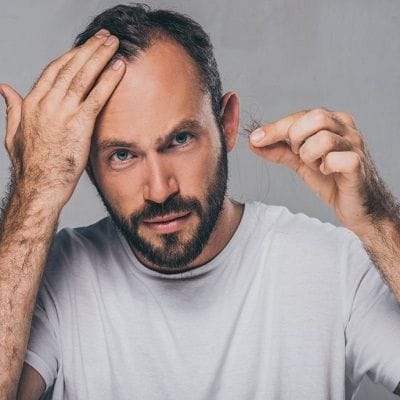 Which Treatment is Best for Bald Hair? 1 Which Treatment is Best for Bald Hair