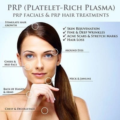 Top 5 Benefits of PRP Treatment 1 Top 5 Benefits of PRP Treatment