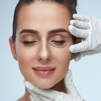 best blepharoplasty surgeon