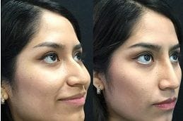 best non-invasive in dubai