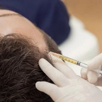 Tips To Improve Your PRP Treatment Results 1 Tips To Improve Your PRP Treatment Results