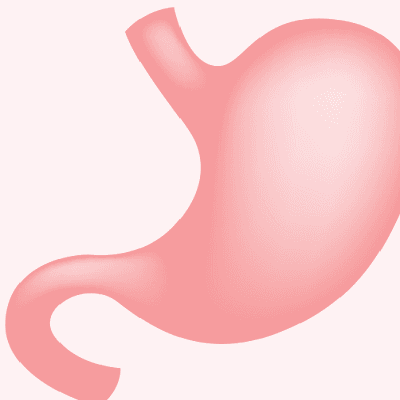 Gastric Sleeve Surgery in Dubai