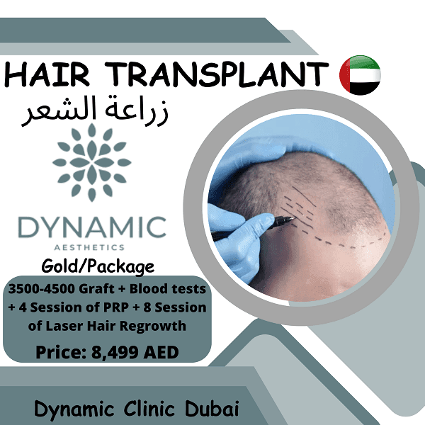 hair transplant gold offer