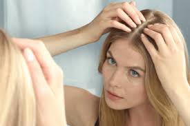 Female Hairline Lowering 3 hair transplant for women