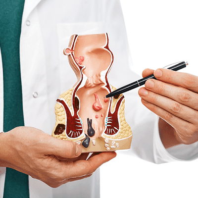 Piles Laser Treatment Cost in Dubai