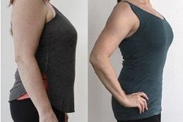 Lipotropic Injections 4 lipotropic-injections in Abu Dhabi